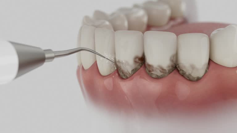 Reliable Dental contractor in Maplewood, MO by Smile Center Dentistry